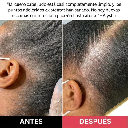 Exfoliante Capilar Revive + Restore | 200 ml