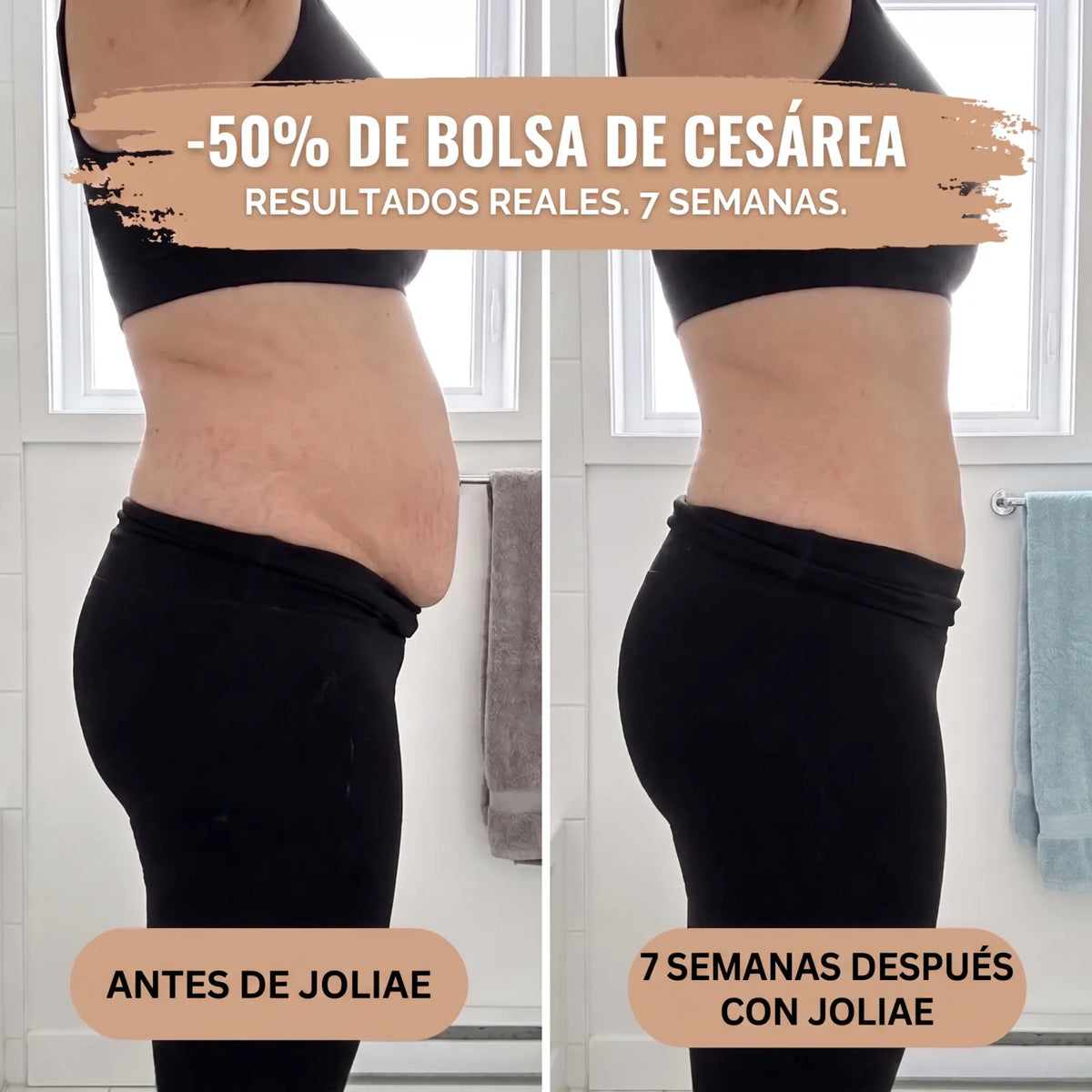 Braga Posparto — Compresión 360° — Antes y después 7 semanas
