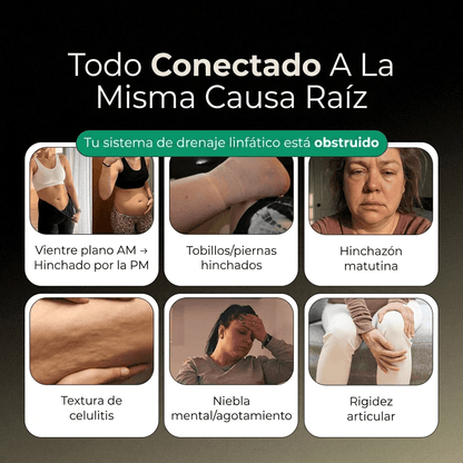 Nueva Fórmula de Máxima Potencia – Cápsulas de Drenaje Linfático de Joliae™