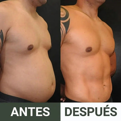 Paquete Desintoxicante De Aceite De Ricino